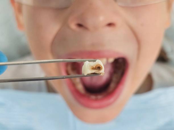 Best Emergency Pediatric Dental Care in Hamilton, IN